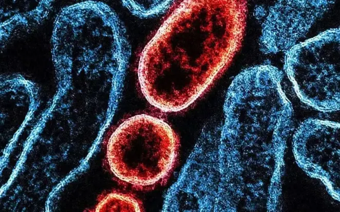 Como cientistas ‘caçam’ vírus pelo mundo para antecipar pandemias